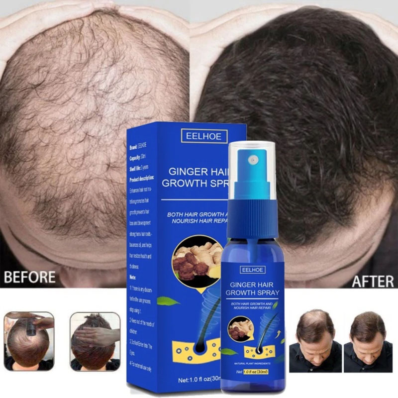 Epidermal Growth Factor - 생강 헤어 성장 세럼 스프레이 탈모