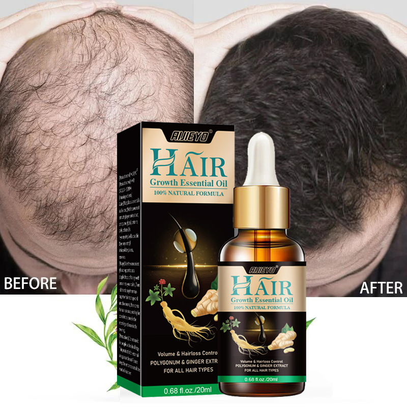 Epidermal Growth Factor - 2023 비오틴 빠른 모발 성장 오일