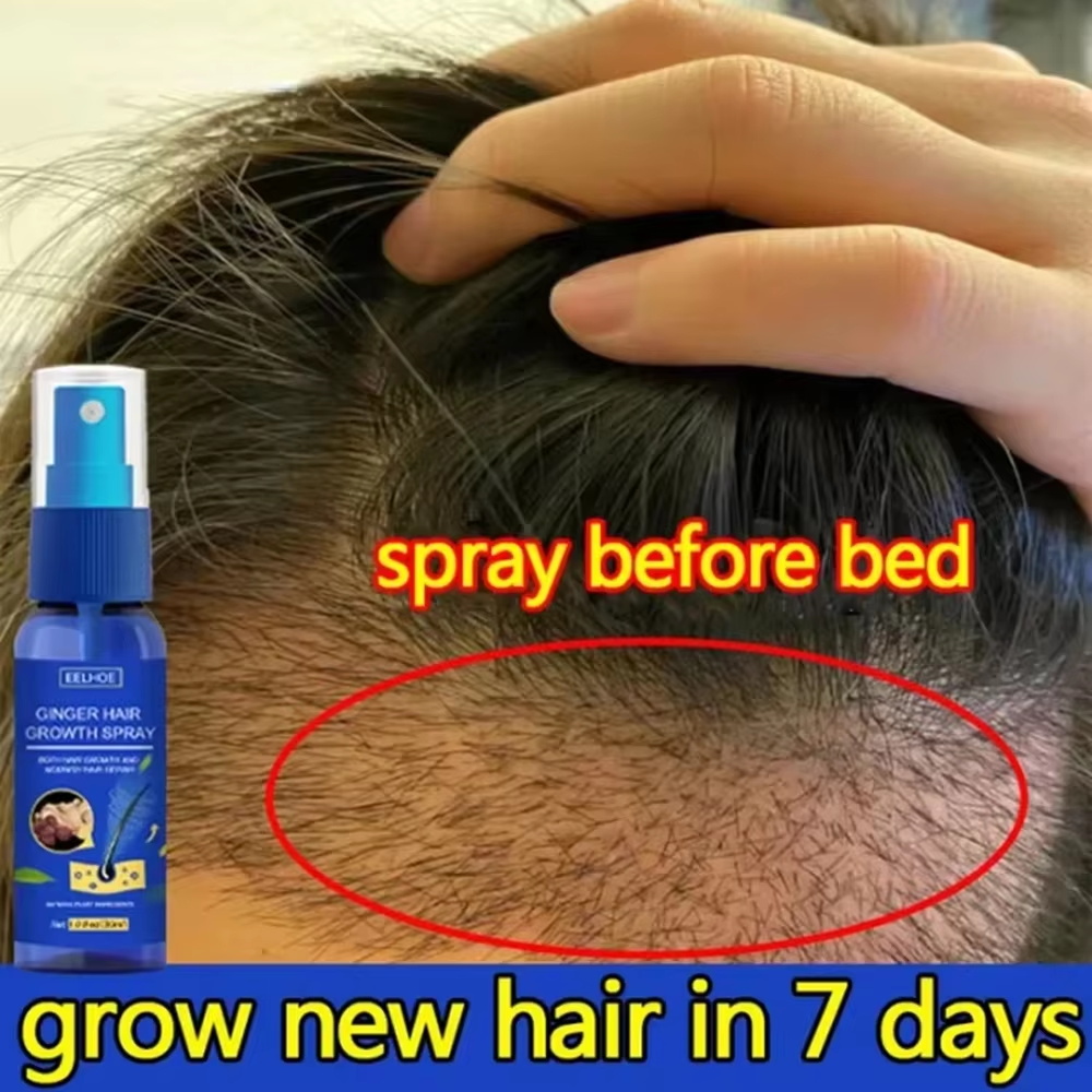 Epidermal Growth Factor - 빠른 생강 모발 성장 스프레이, 모발