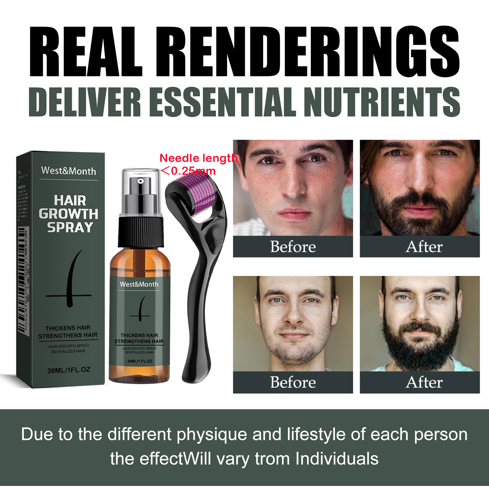 남성용 수염 스프레이 키트 (마이크로 롤러 0.25mm - Epidermal Growth Factor 리뷰 및 가격
