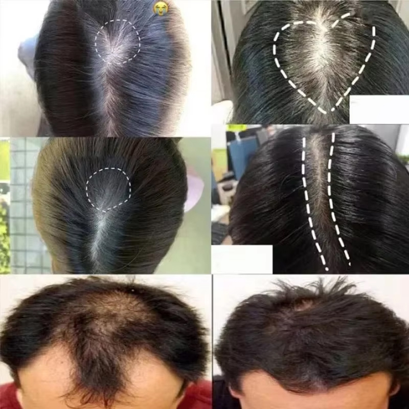 생강 헤어 성장 세럼 스프레이 탈모 방지 재성장 헤어  - Epidermal Growth Factor 리뷰 및 가격