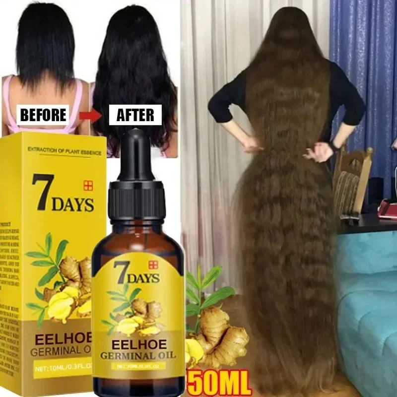 빠른 모발 성장 오일 생강 성장 헤어 트리트먼트, 탈모 - Epidermal Growth Factor 리뷰 및 가격