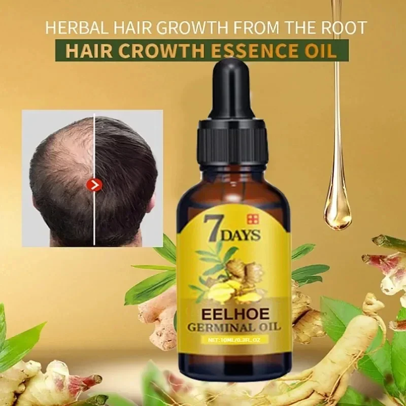 빠른 모발 성장 오일 생강 성장 헤어 트리트먼트, 탈모 - Epidermal Growth Factor 리뷰 및 가격
